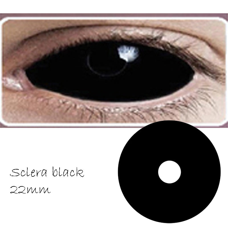 Sclera black